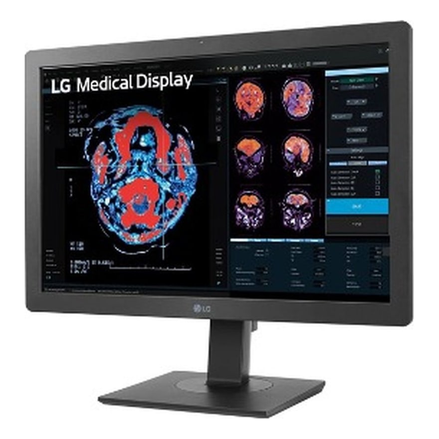 MONITOR LGX 24INCH 2MP IPS DIAGNOSTIC